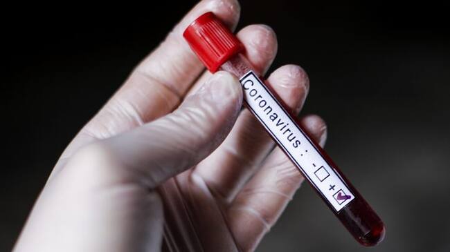 A doctor holds blood work tube about corona virus