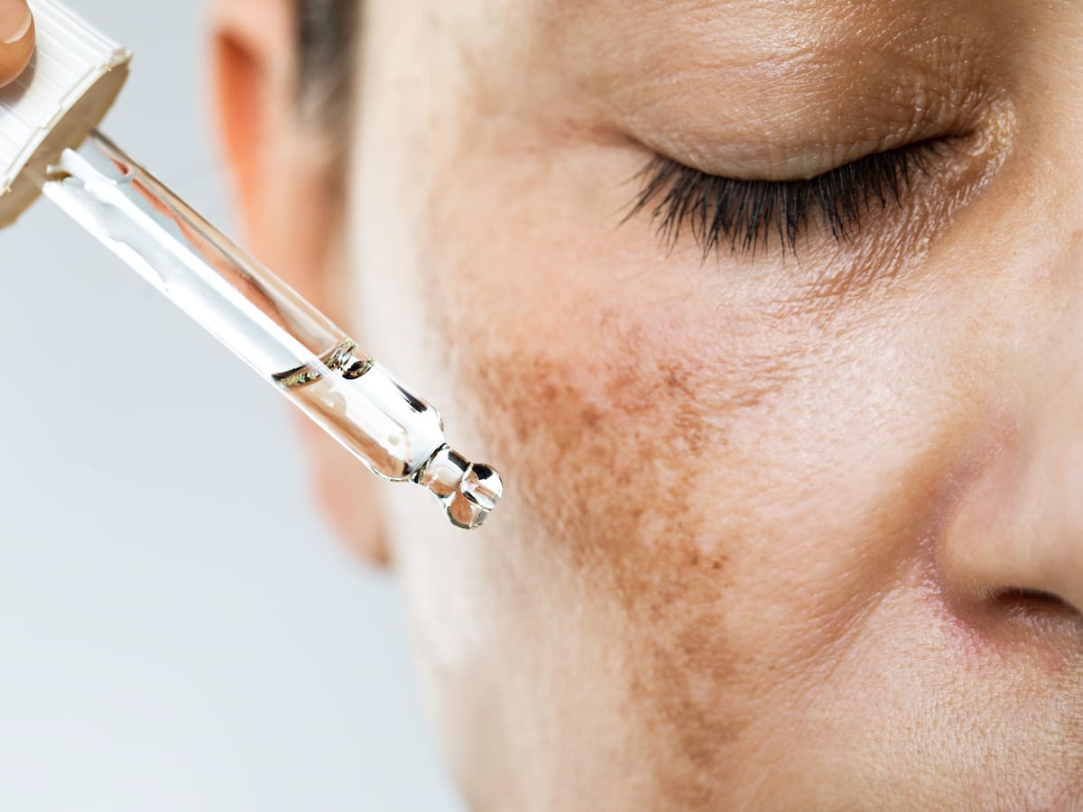 ¿Qué es la Midorexia y cómo enfrentarla? Dermatóloga entrega consejos para cuidar tu piel en el envejecimiento