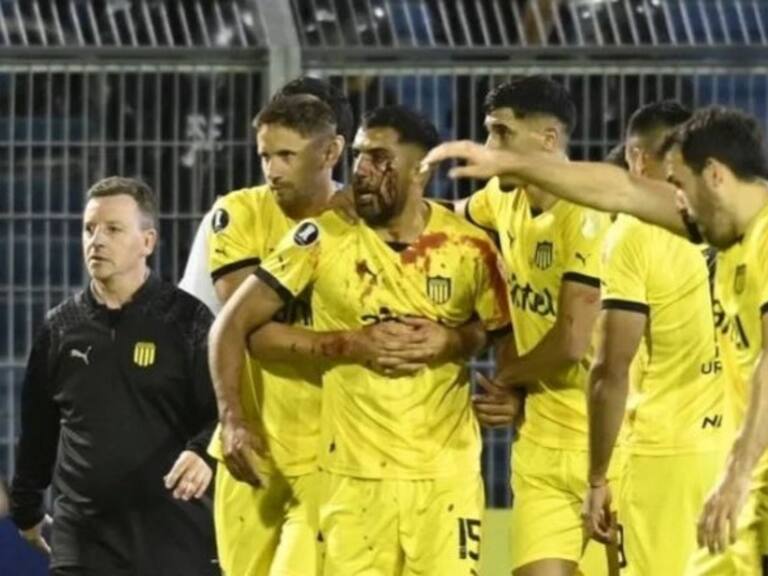 Hinchas de Rosario Central agreden a jugador de Peñarol con un proyectil en su rostro: futbolista terminó en el hospital
