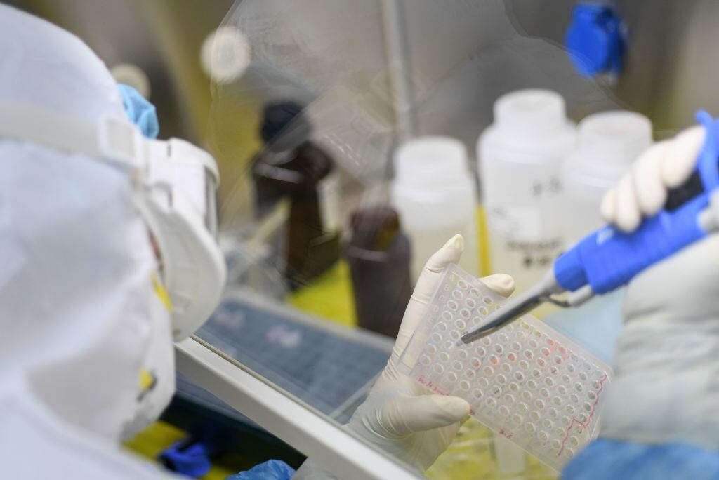 Un científico investiga la enfermedad del SARS-Cov-2.