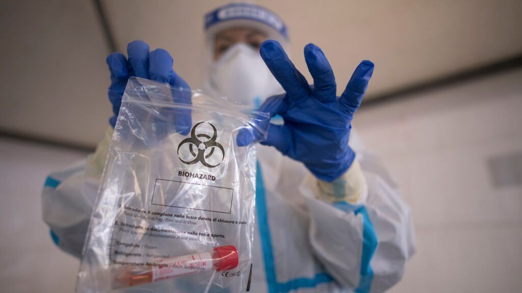 Examen del nuevo coronavirus en Turín