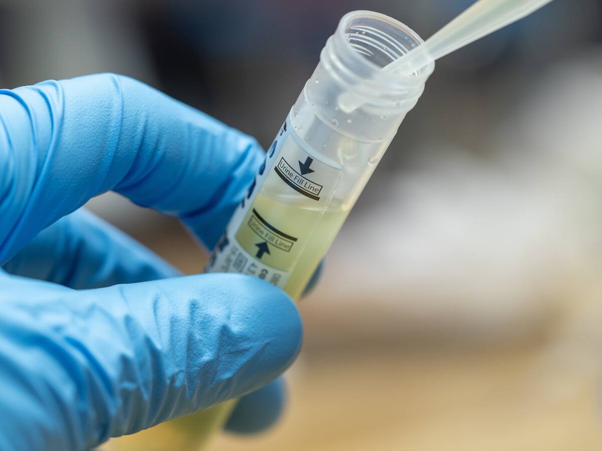 Gerente General de empresa detrás de elaboración de PCR chileno: «Los test de distinto tipo van a acompañarnos por un largo tiempo»