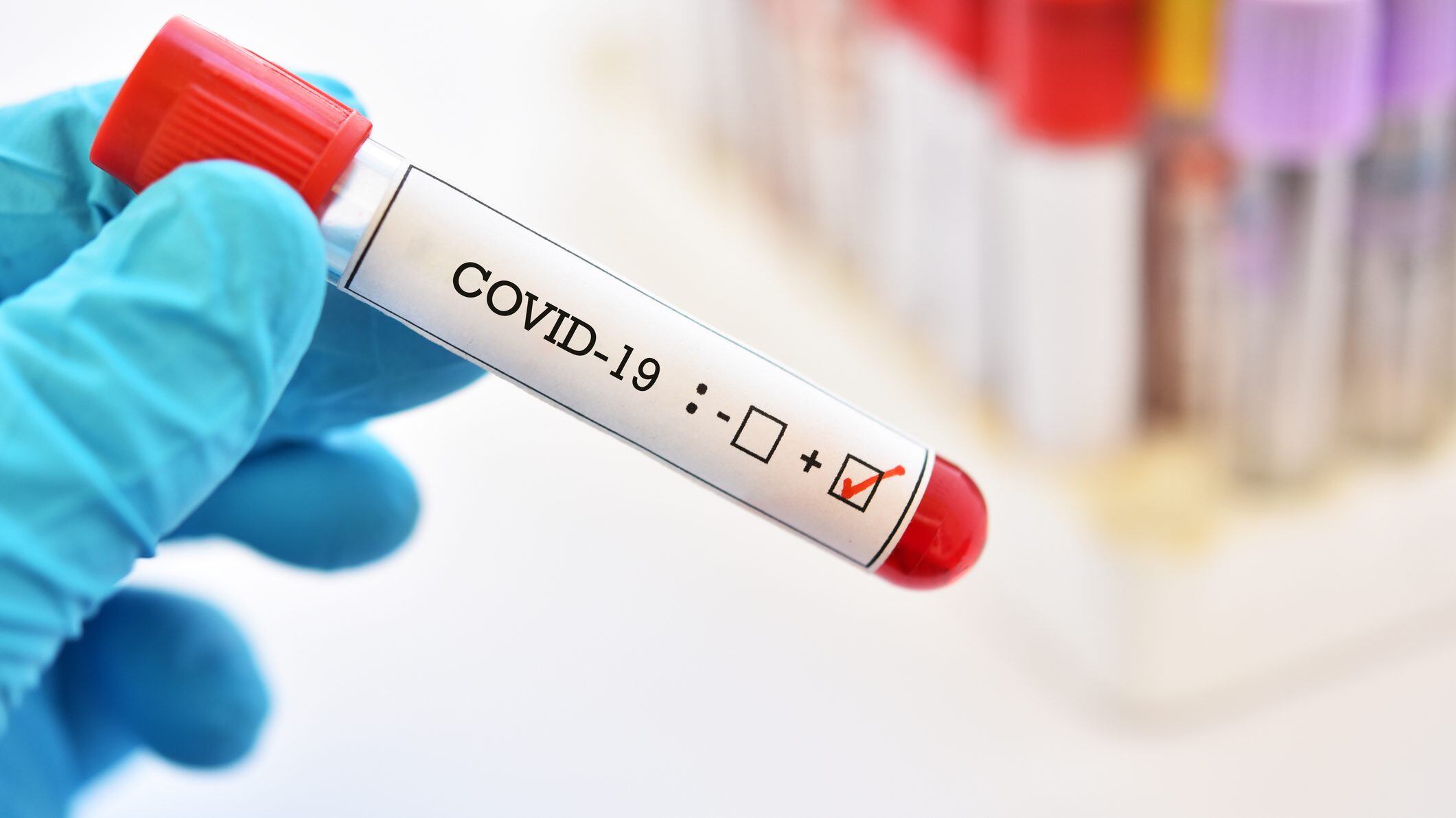 Blood sample tube positive with COVID-19 or novel coronavirus 2019 found in Wuhan, China