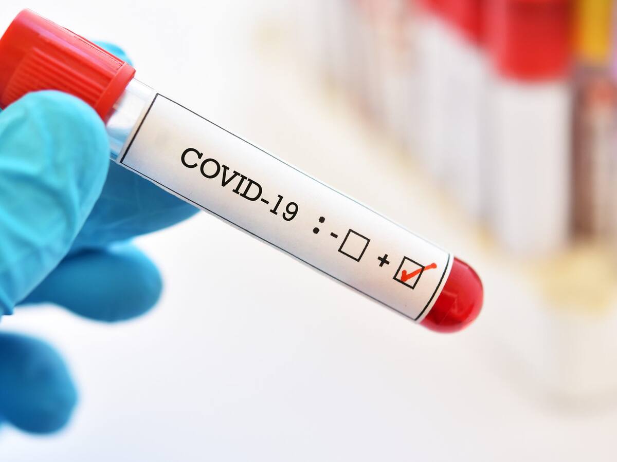 Minsal informó que hubo 1.712 nuevos casos y ya son 321.205 los contagiados con coronavirus