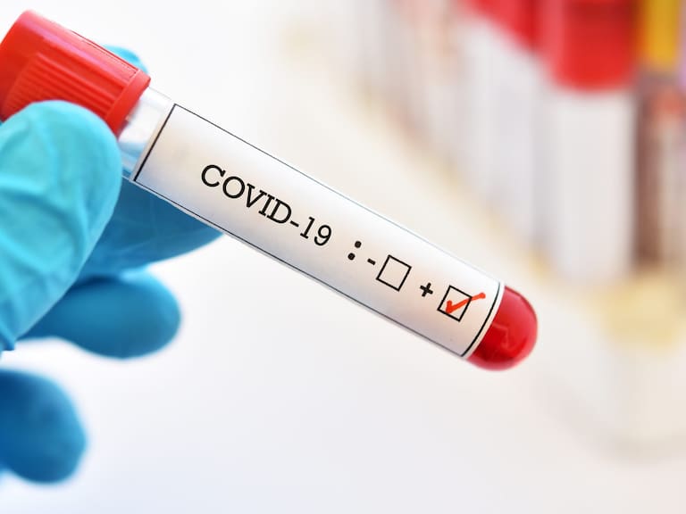 Blood sample tube positive with COVID-19 or novel coronavirus 2019 found in Wuhan, China