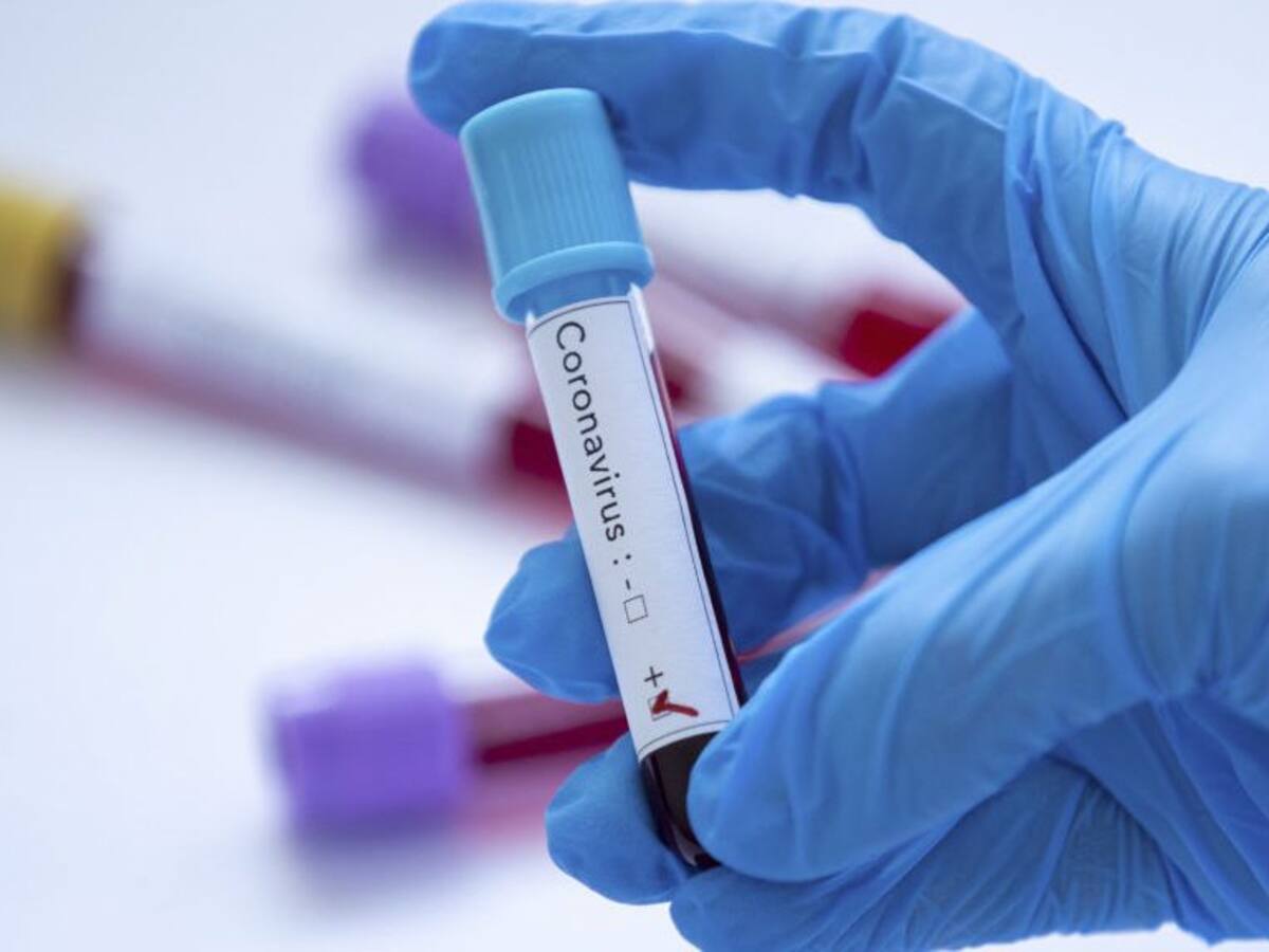 Minsal informó que hubo 4.942 nuevos contagios y ya son 113.628 los casos de coronavirus