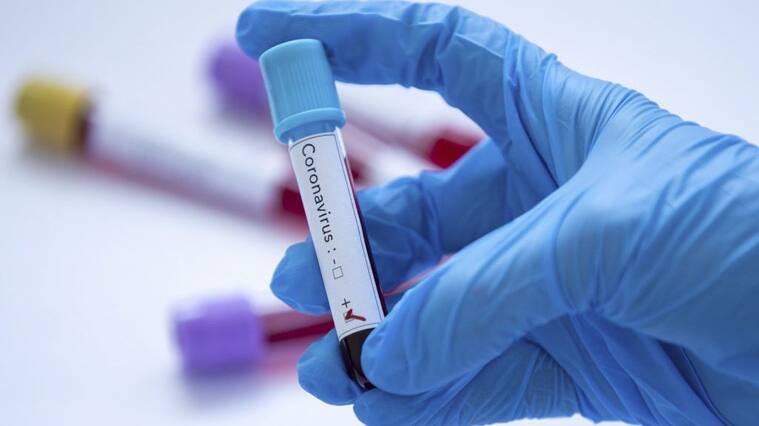 ANKARA, TURKEY - FEBRUARY 14: In this photo illustration a coronavirus (2019-nCoV) positive blood sample is displayed on February 14, 2020 in Ankara, Turkey. Aytac Unal / Anadolu Agency