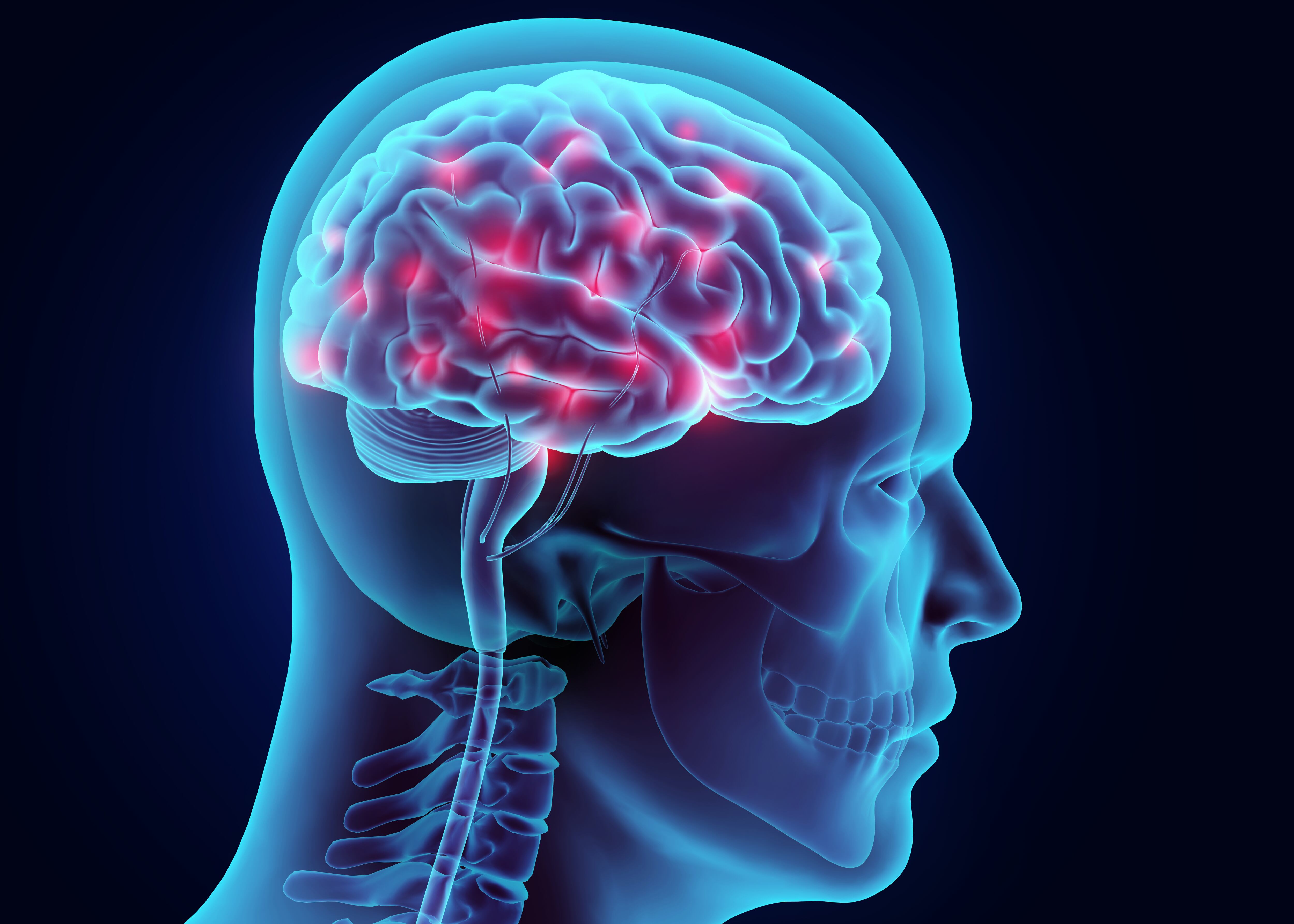 Cerebro