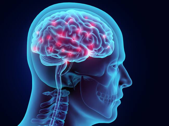 Cerebro