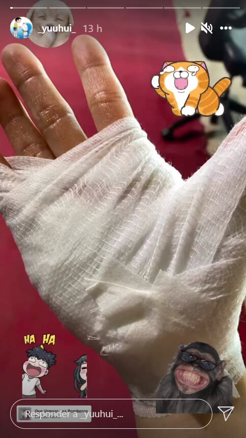Yuhui Lee sufrió un accidente en la cocina de El Discípulo del Chef