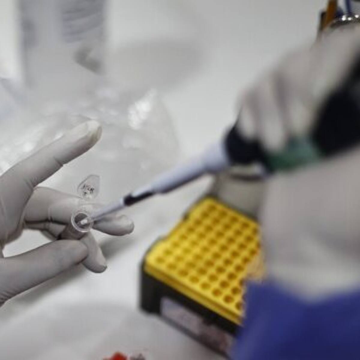 Argentina confirma su primer caso de Mpox Clado Ib, variante más contagiosa y severa de la viruela símica