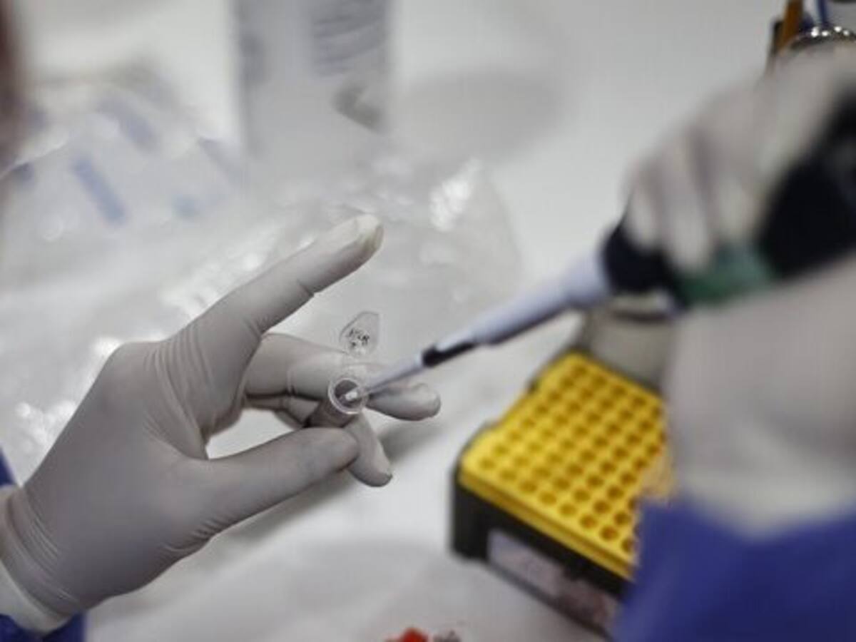 Argentina confirma su primer caso de Mpox Clado Ib, variante más contagiosa y severa de la viruela símica