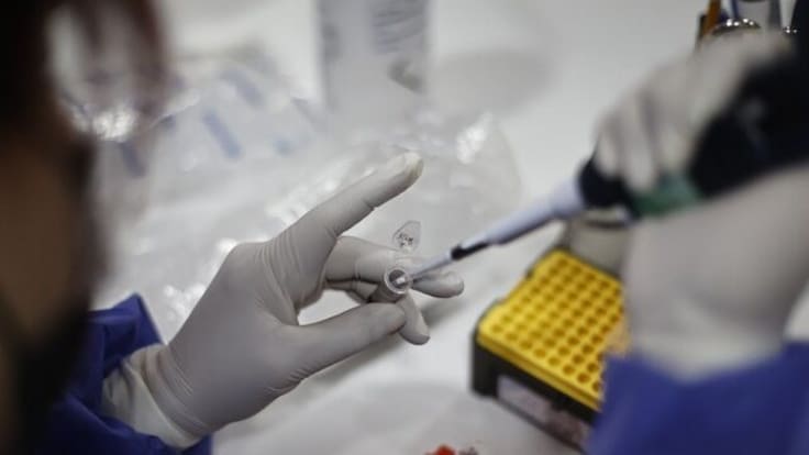 Argentina confirma su primer caso de Mpox Clado Ib, variante más contagiosa y severa de la viruela símica