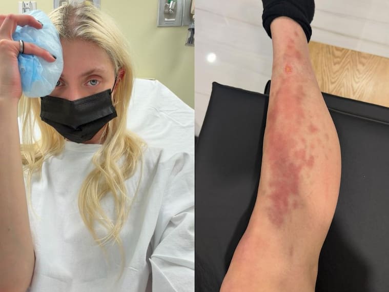 CAPTURA