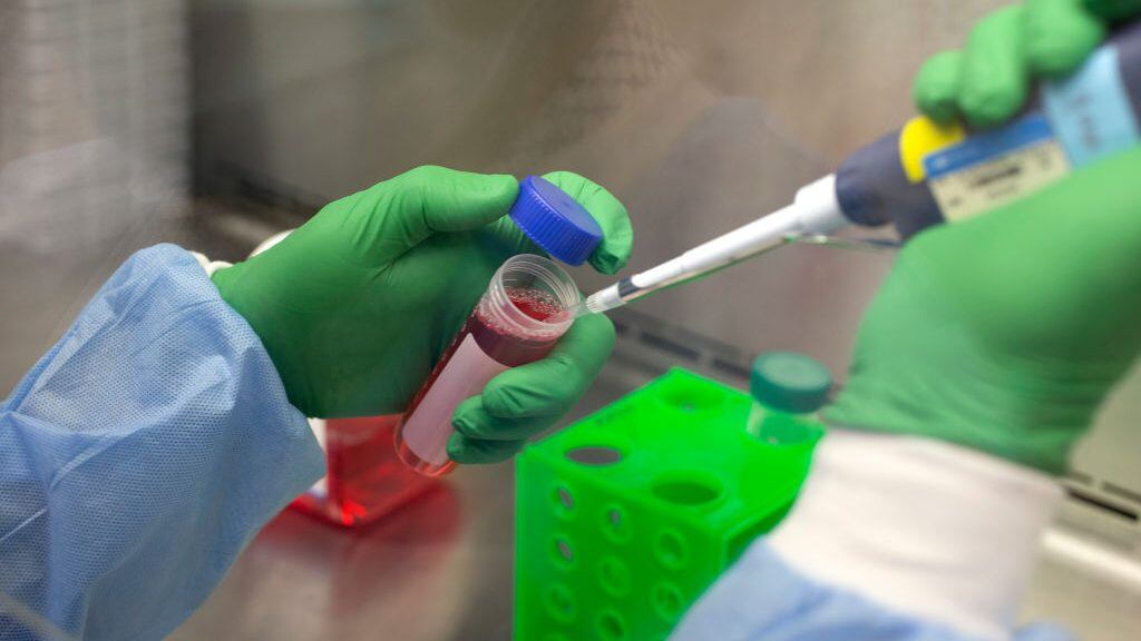 SEATTLE, WA - DECEMBER 11: Dr. Jesse Erasmus dilutes a serum samples collected from animals that received a replicon, or replicating, RNA vaccine being developed to combat Covid-19 (SARS-CoV-2), at a microbiology lab at the University of Washington School of Medicine on December 11, 2020 in Seattle, Washington. Scientists are hoping this nucleic acid vaccine will only need one dose to be effective against the coronavirus and that it won't need to be stored in a deep freeze. This replicon RNA vaccine has been tested on mice and macaque monkeys and is in early stage clinical development with HDT Bio who will be leading the clinical trials of it in the United States. The serum samples will help determine the quantity of neutralizing antibodies. (Photo by Karen Ducey/Getty Images)