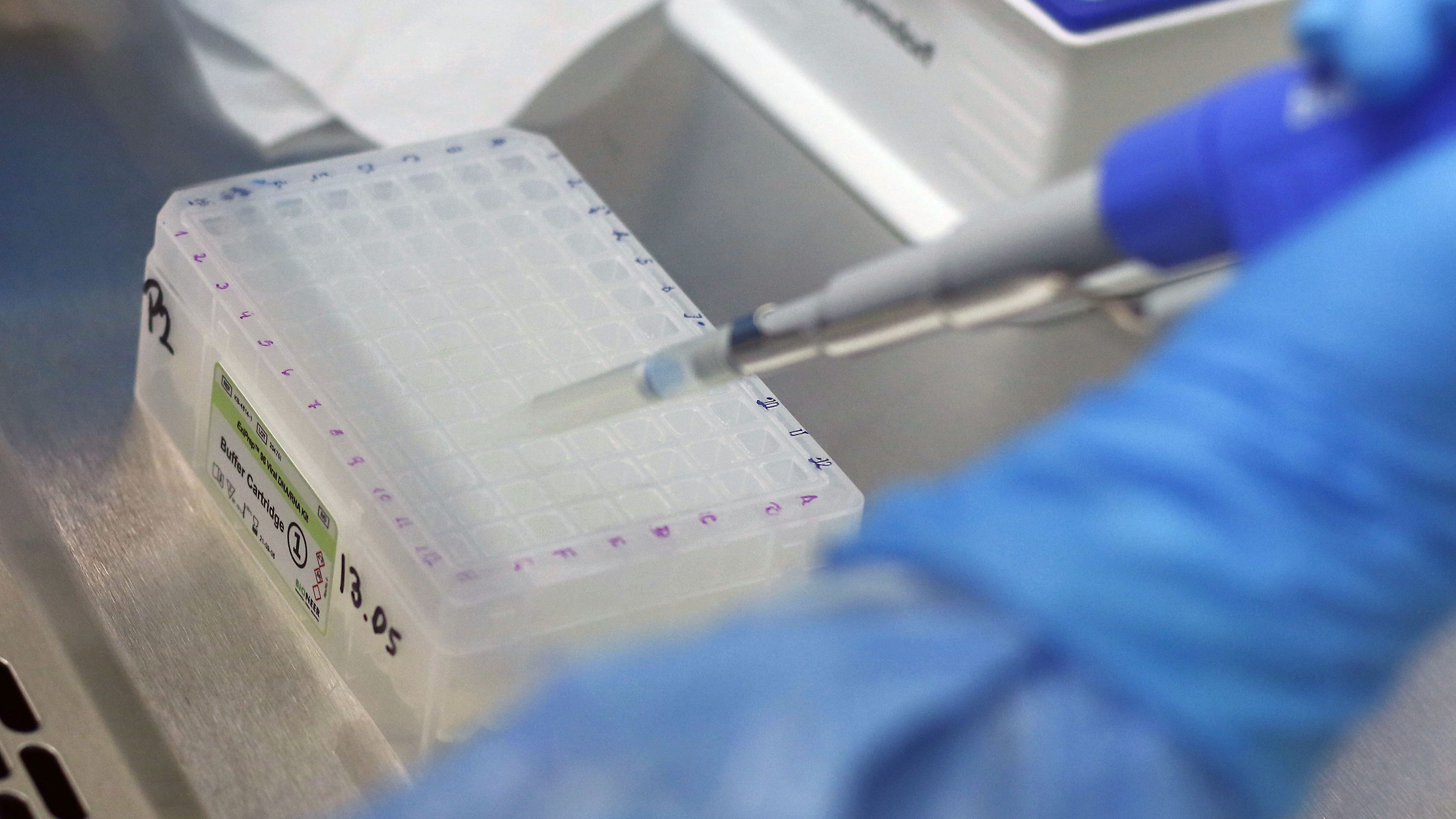 ISP lidera estudio sobre respuesta inmune contra el virus del covid-19