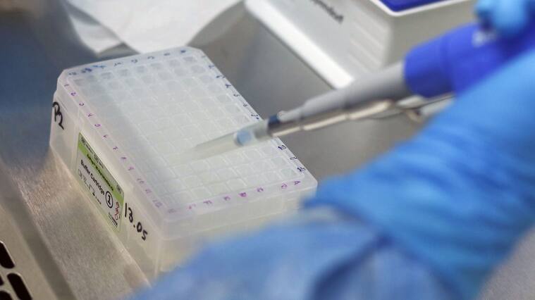 ISP lidera estudio sobre respuesta inmune contra el virus del covid-19
