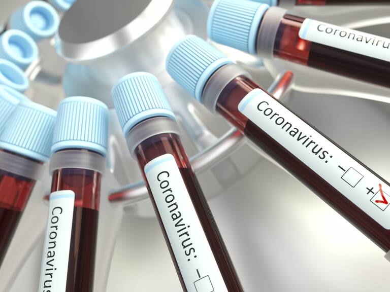 Coronaviruses research, conceptual illustration. Vials of blood in a centrifuge being tested for coronavirus infection.