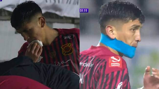 Jugador de Rangers se roba las miradas por inusual vendaje durante el partido ante Temuco