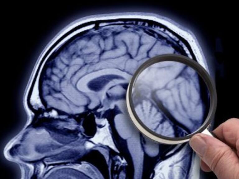 Realizan investigación para tratar alzheimer con nanopartículas de oro: académico Marcelo Kogan explicó de qué se trata