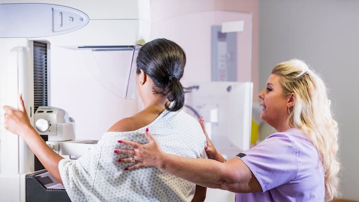 4 de cada 10 mujeres en Chile tienen su mamografía al día: expertos advierten que la cifra es preocupante
