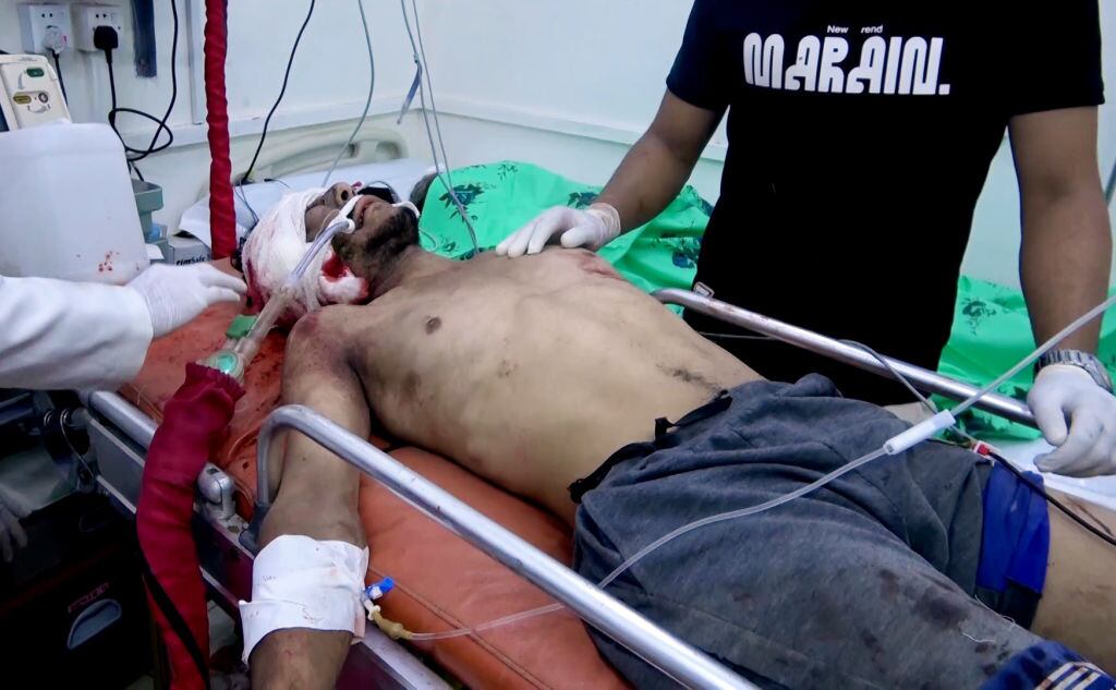 Un hombre herido es atendido en el Houthi Media Center, tras sobrevivir al bombardeo lanzado por Estados Unidos y Reino Unido contra Yemen.