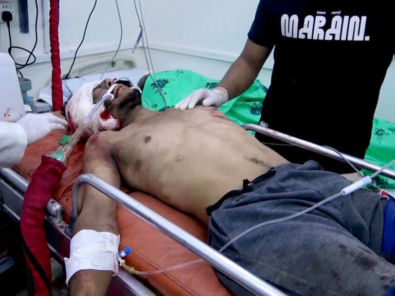 Un hombre herido es atendido en el Houthi Media Center, tras sobrevivir al bombardeo lanzado por Estados Unidos y Reino Unido contra Yemen.