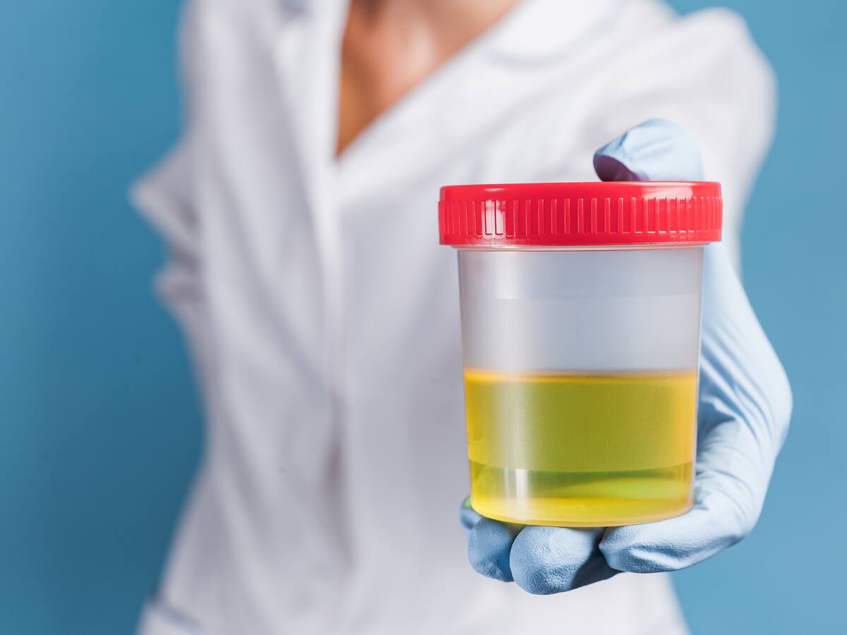 Rojo, marrón o amarillo: qué significa cada color de la orina (y qué indica sobre la salud)