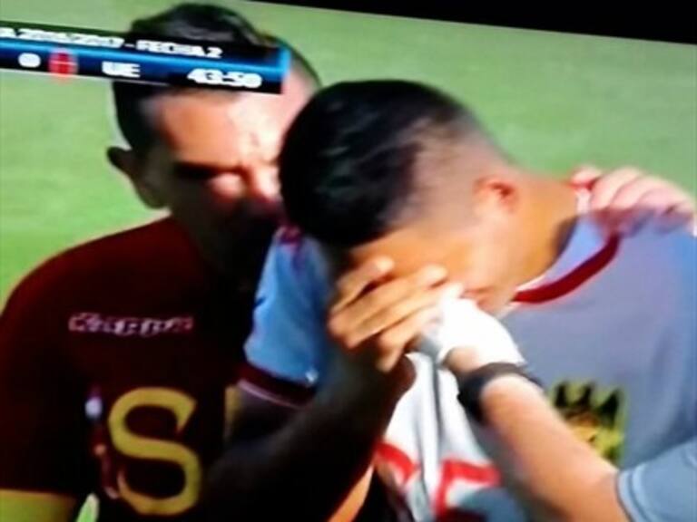 Arquero de Unión Española sufrió una fractura nasal en el duelo ante O’Higgins