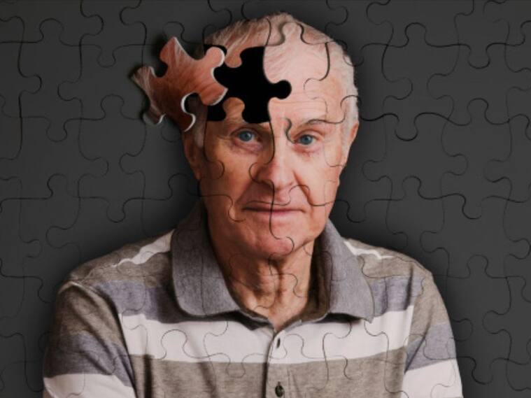 Alzheimer en Chile: ¿Cuál es la realidad de este diagnóstico en el país?