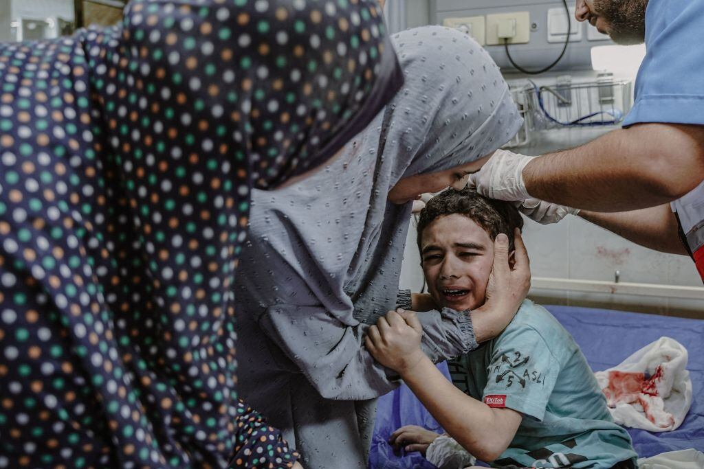 Niño palestino es atendido en un hospital en Gaza tras un bombardeo israelí