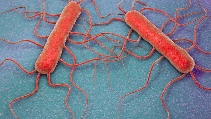 Minsal anuncia alerta sanitario por Listeria