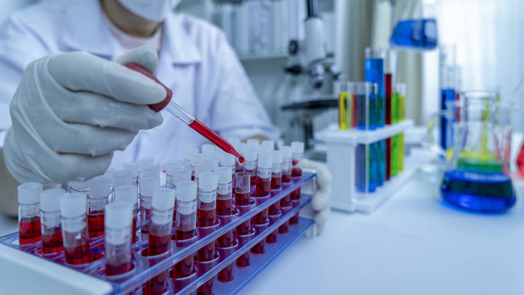 hands of a lab technician with a tube of blood sample and a rack with other samples / lab technician holding blood tube sample for study