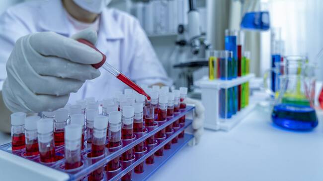 hands of a lab technician with a tube of blood sample and a rack with other samples / lab technician holding blood tube sample for study