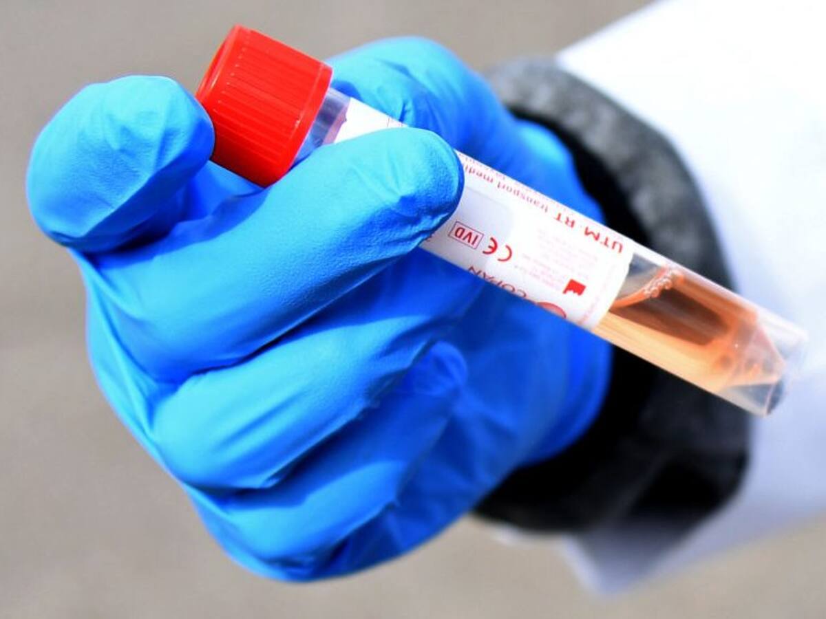 Minsal informó que hay 5.546 contagiados en Chile con coronavirus y 48 fallecidos