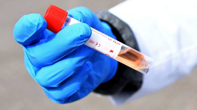Un test de coronavirus se realiza en la Universidad de Nevada Las Vegas