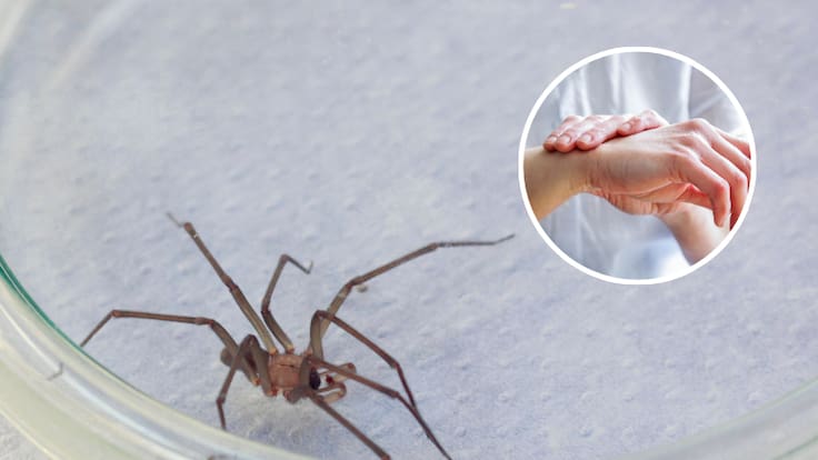Temporada de la araña de rincón en Chile: esto es lo primero que debes hacer si sufres una picadura