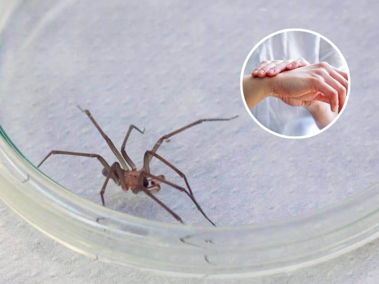 Arañas de rincón en Chile: esto es lo que primero que debes hacer si sufres una mordedura