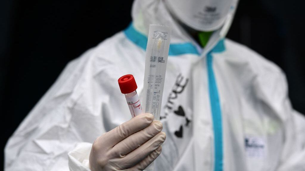 A hospital employee wearing protection mask and gear shows a swab, a cotton wab for taking mouth specimen, used at a temporary emergency structure set up outside the accident and emergency department, where any new arrivals presenting suspect new coronavirus symptoms will be tested, at the Brescia hospital, Lombardy, on March 13, 2020. (Photo by Miguel MEDINA / AFP) (Photo by MIGUEL MEDINA/AFP via Getty Images)