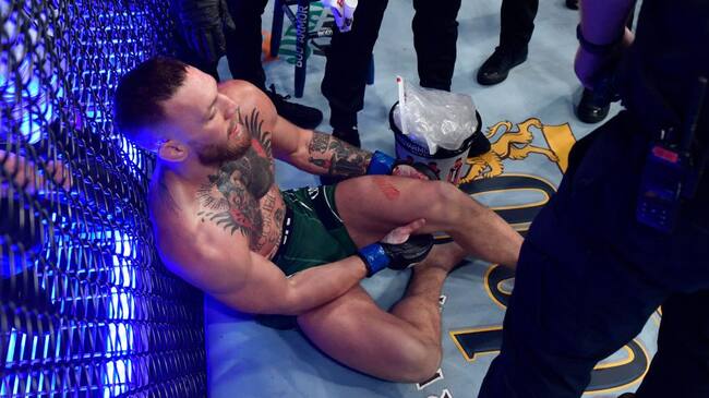 McGregor sufrió una impactante fractura