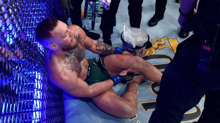 McGregor sufrió una impactante fractura
