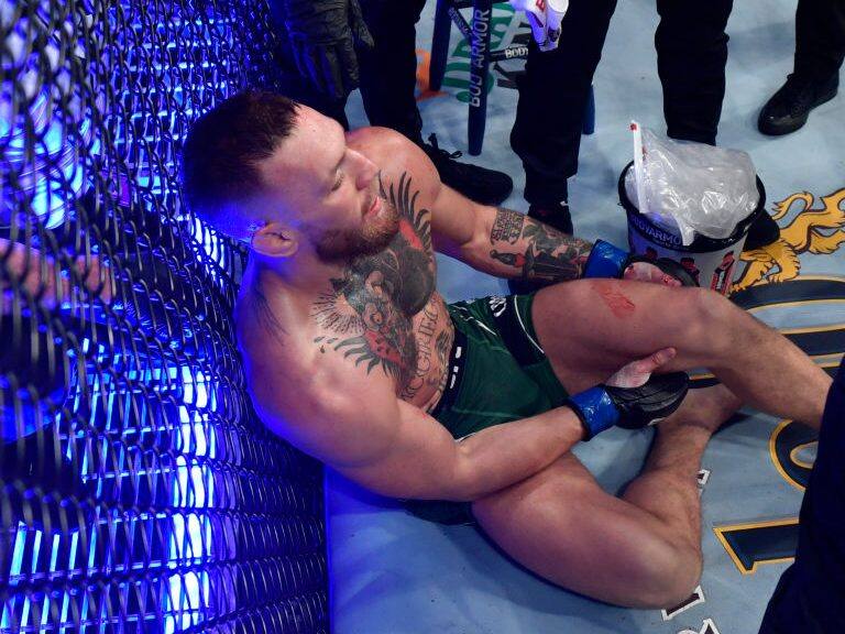 McGregor sufrió una impactante fractura