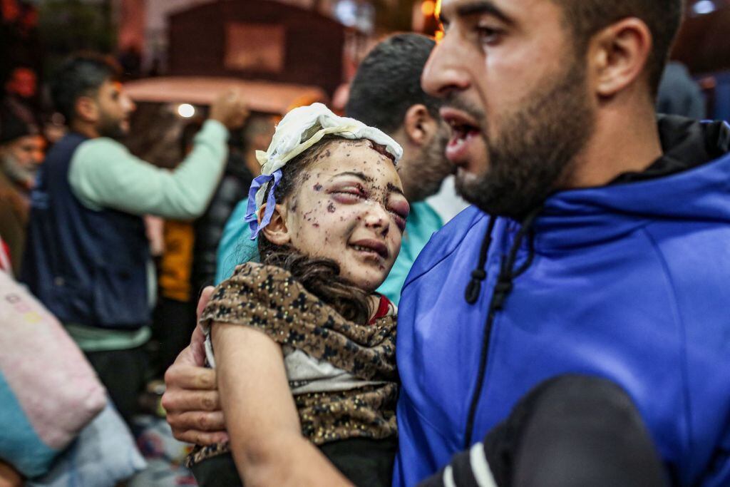 Niña herida es trasladada tras ataque de Israel contra un hospital en Gaza