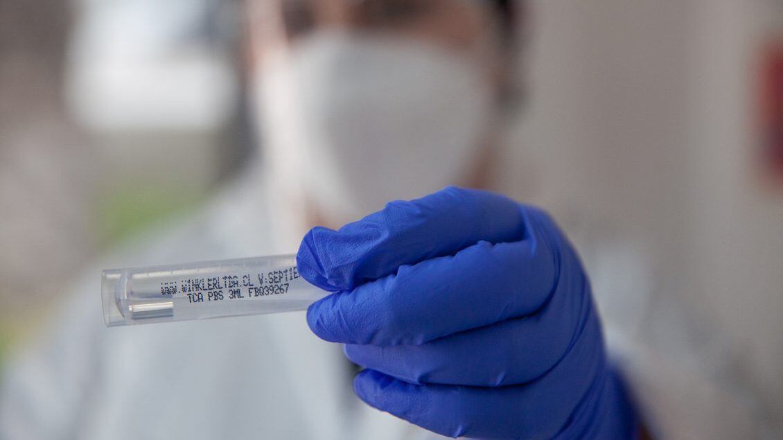 07 de Enero de 2022/SANTIAGO
Operativo exámenes PCR para la detección del Virus Covid-19 y trazabilidad. Ministerio de Salud informa 3.799 casos nuevos de COVID-19, con una positividad de 4,75% en las últimas 24 horas a nivel nacional, con 74.482 exámenes, PCR y test de antígeno.

FOTO BASTIÁN CIFUENTES /AGENCIAUNO