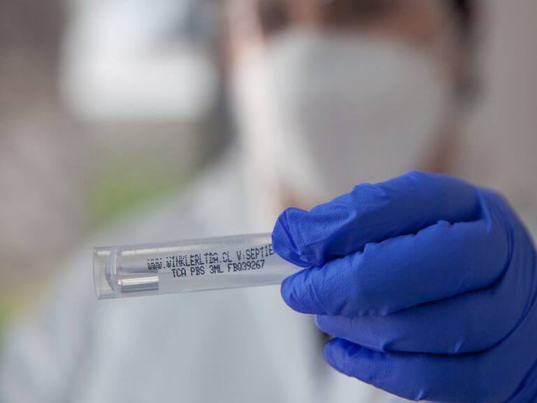 07 de Enero de 2022/SANTIAGO
Operativo exámenes PCR para la detección del Virus Covid-19 y trazabilidad. Ministerio de Salud informa 3.799 casos nuevos de COVID-19, con una positividad de 4,75% en las últimas 24 horas a nivel nacional, con 74.482 exámenes, PCR y test de antígeno.
FOTO BASTIÁN CIFUENTES /AGENCIAUNO