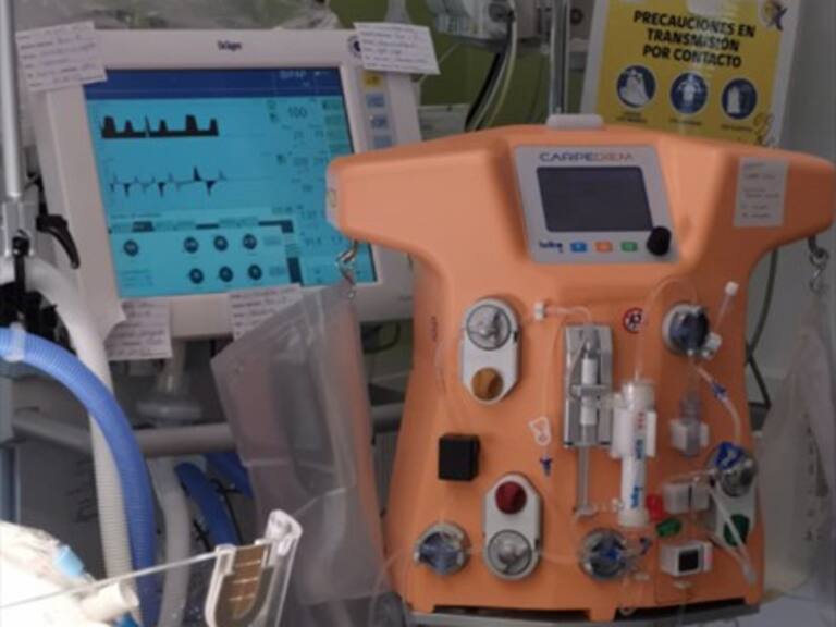 Se crea en Chile la primera máquina de hemodiálisis para recién nacidos