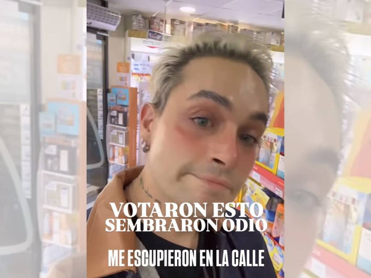 Cantante chileno denuncia violenta agresión en pleno Santiago: “Me acaban de escupir en la calle, en la cara”