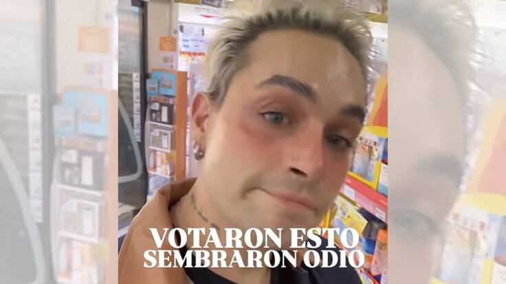 Cantante chileno denuncia violenta agresión en pleno Santiago: “Me acaban de escupir en la calle, en la cara”