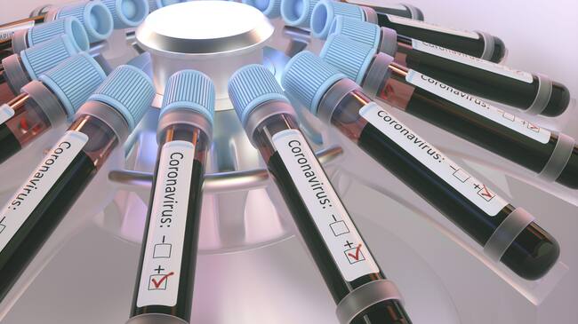 Coronaviruses research, conceptual illustration. Vials of blood in a centrifuge being tested for coronavirus infection.