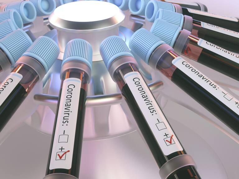Coronaviruses research, conceptual illustration. Vials of blood in a centrifuge being tested for coronavirus infection.